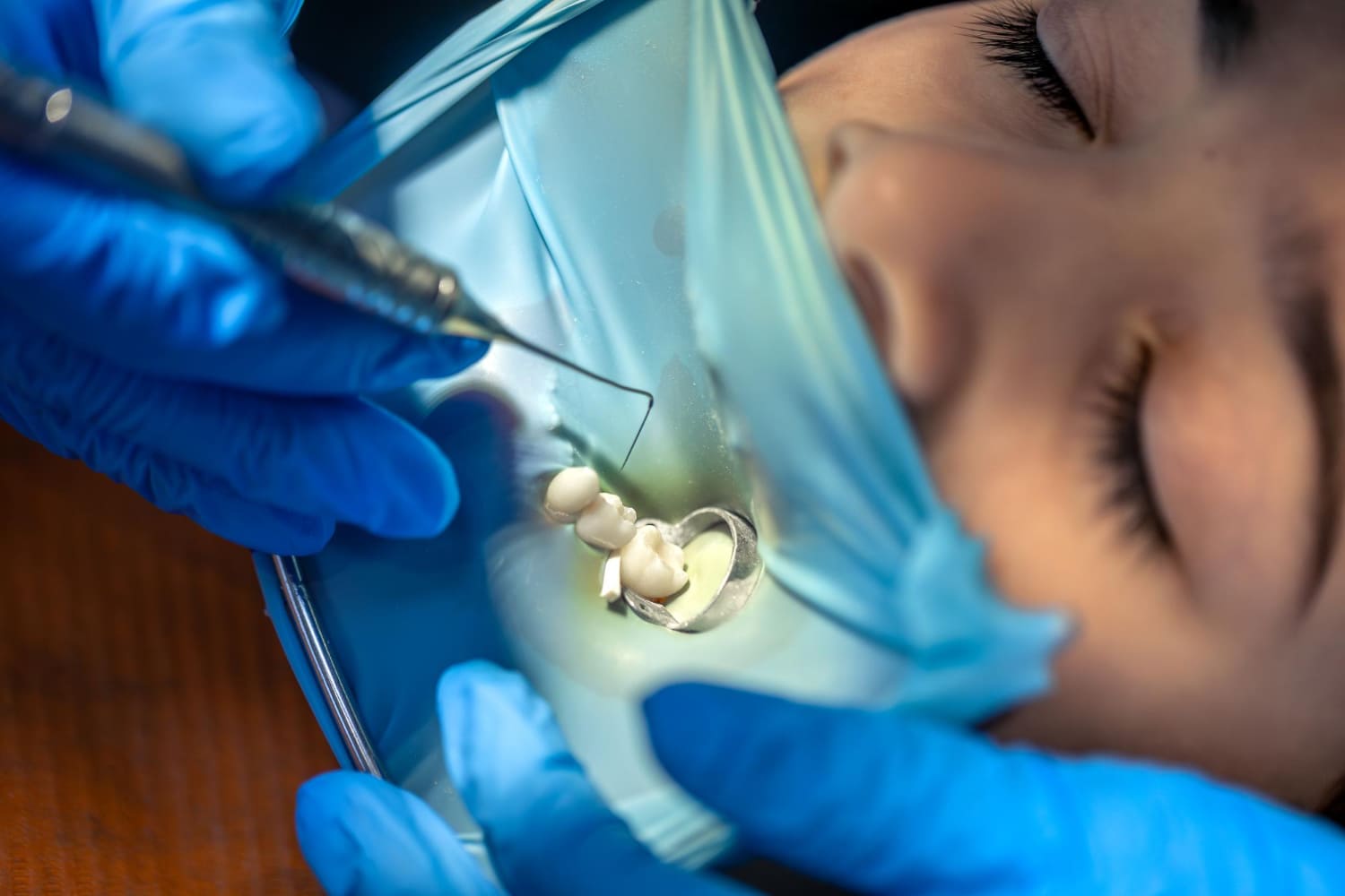 cirugía dental montornés del vallés